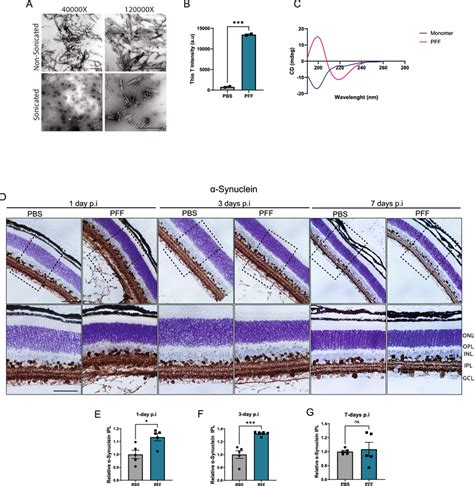 Uptake Of α Synuclein Fibrils Following Pffs Intravitreal Injection A