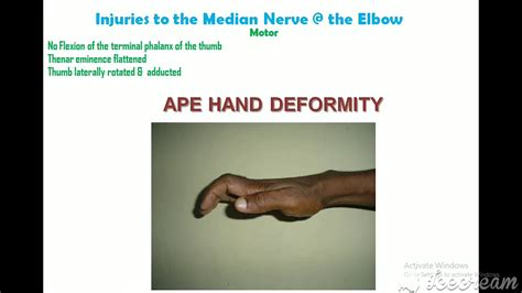 Ape And Claw Hand Youtube