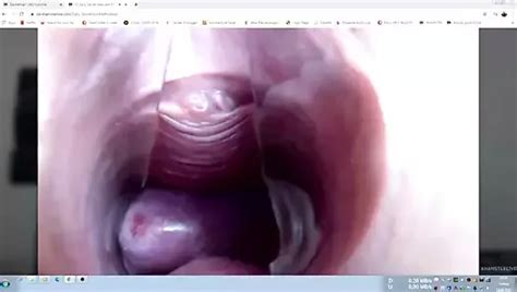 Free Cervix Speculum Porn Videos 2 XHamster