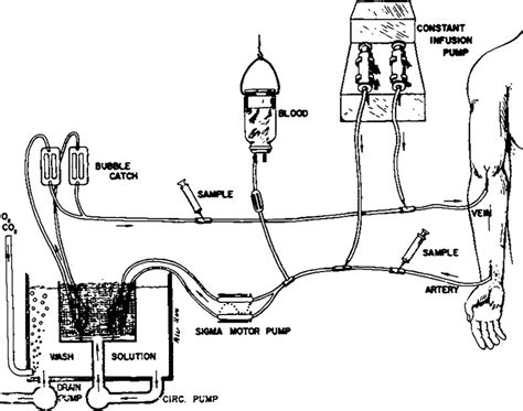 Regional Heparinization For Hemodialysis — Technic And Clinical