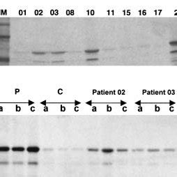 A Immunoprecipitation Of In Vitro Translated P53 With Sera From