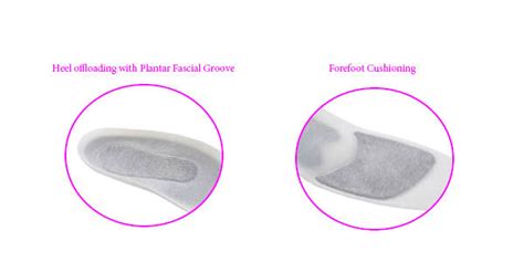 Sense Offload Buchanan Orthotics