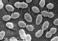 Micrographs of four Leuconostoc species