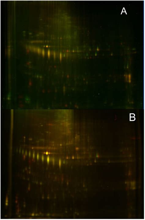 Representative Two Dimensional Differential Gel Electrophoresis Download Scientific Diagram