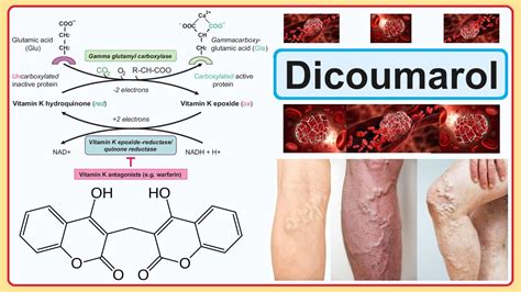 dicoumarol - YouTube