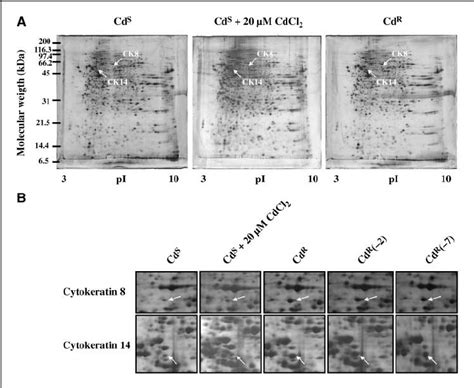 Representative Proteome Profiles Between Cadmium Sensitive And