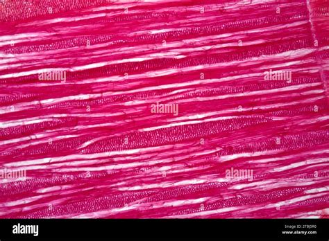 Tracheids, a kind of xylem. Optical microscope X40 Stock Photo - Alamy