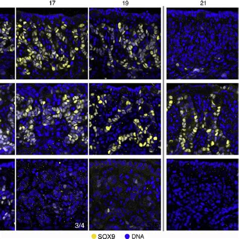 Sox9 Expression Becomes Male Specific After Sex Determination A At