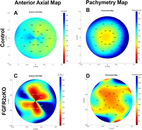 Representative Corneal Topography Axial Maps And Pachymetry Maps Of