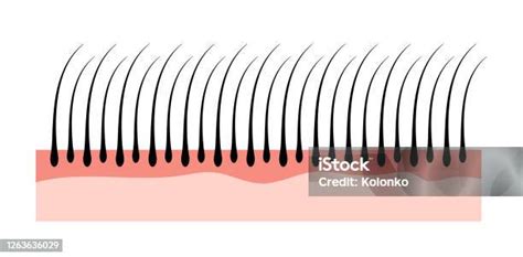 인간의 모발 피부 구조 성장 표피 모발 해부학 개념 만화에 대한 스톡 벡터 아트 및 기타 이미지 만화 모낭 3차원 형태