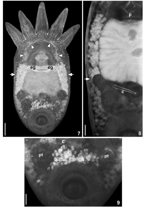 Temnocephala Pereirai Juveniles Cleared In Lactophenol Juvenile