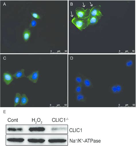 CLIC1 Protein Translocates To The Cell Membrane During H 2 O 2 Exposure