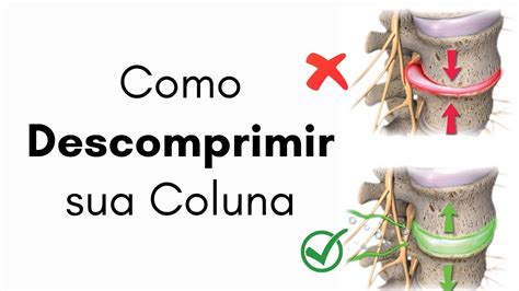 Como DESCOMPRIMIR sua Coluna 3 exercícios para Salvar sua Coluna