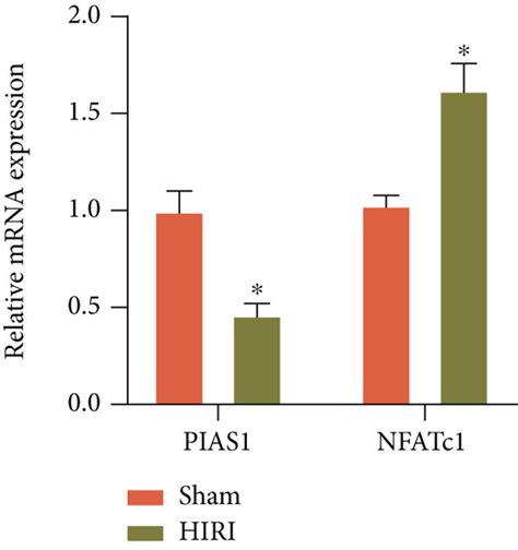 The Effect Of PIAS1 On NFATc1 SUMOylation And The Inflammatory Response