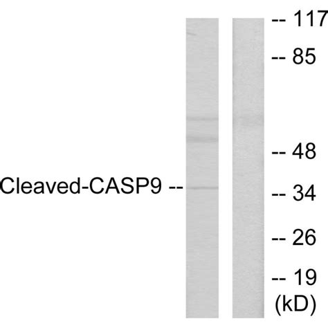 Caspase 9 Cleaved Asp330 Polyclonal Anti Human