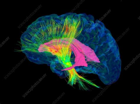 Brain fibres, DTI MRI scan - Stock Image C017/7036 - Science Photo Library