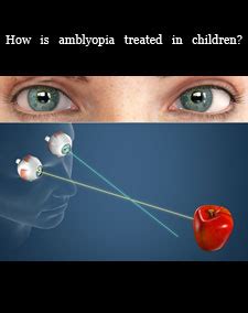 Amblyopia - treatment of Amblyopia ,types Diseases, Index A –Z, medicines, Amblyopia symptoms ...