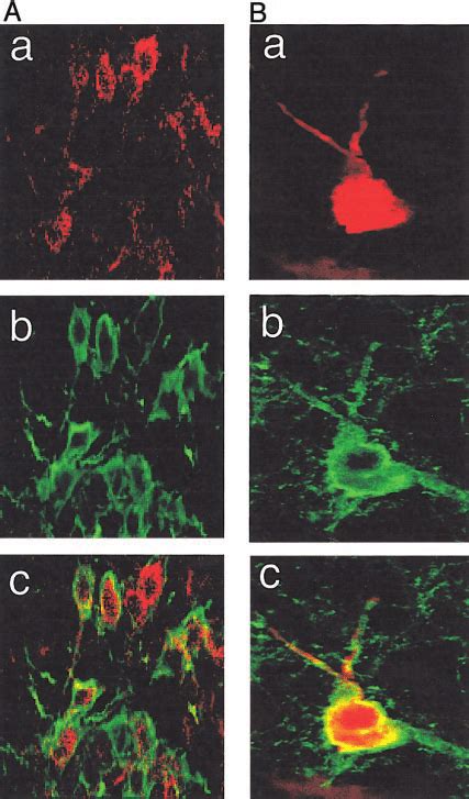 Photomicrographs Showing DiI Labeled LC Noradrenergic Neurons Images