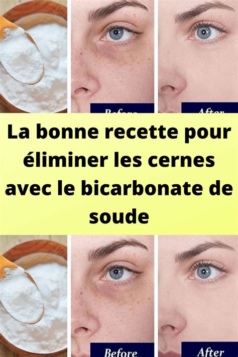 La Bonne Recette Pour Liminer Les Cernes Avec Le Bicarbonate De Soude