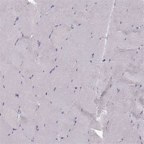 Rabbit Polyclonal Anti-KLF17 Antibody - Buy for research - Highly ...