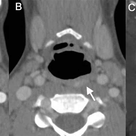 Contrast-enhanced CT imaging was performed with a limited field of view... | Download Scientific ...