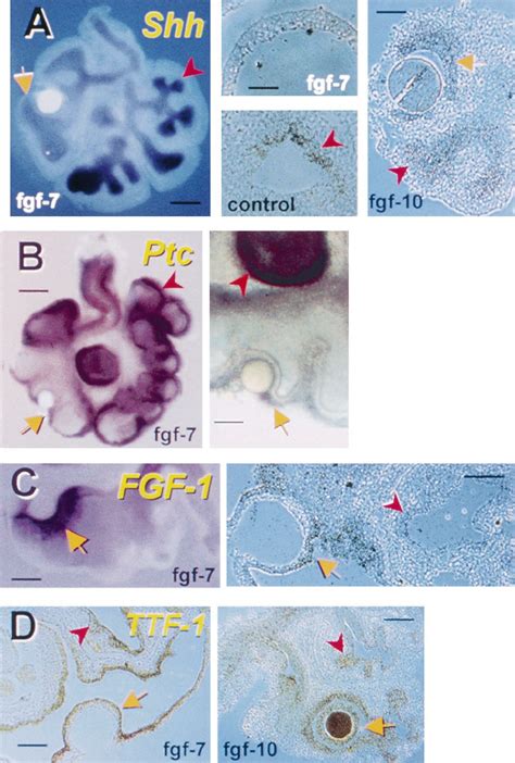 gene expression analysis  lung organ cultures grafted  fgf