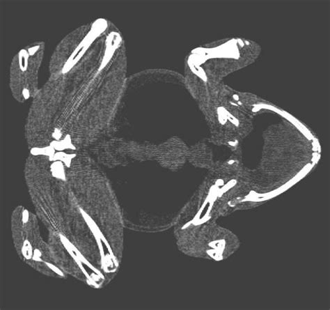 A Single Mid Frontal Slice Of The Clinical Ct Scanner Dicom Image