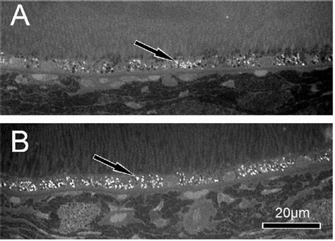 Semi Thin Sections Of Rpe Cell Layers Of Month Old Abca Mice