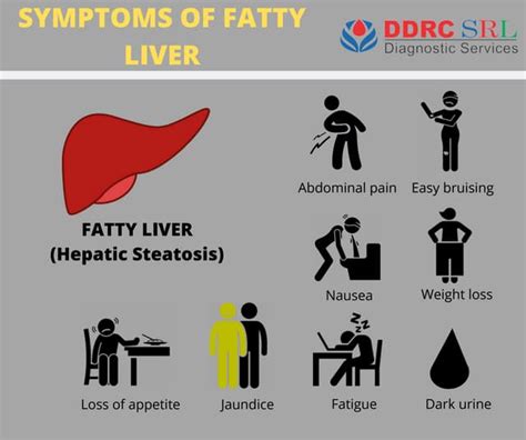 Symptoms Of Fatty Liver Hepatic Steatosis Ppt