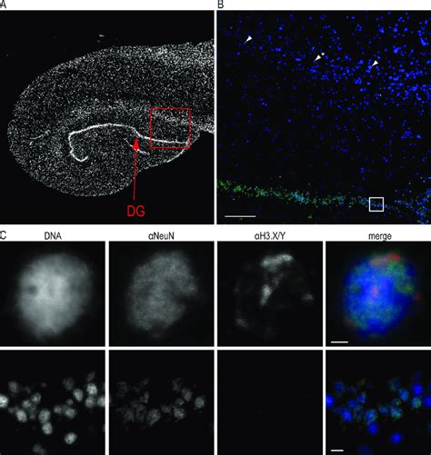 H X Y Protein Expression In Human Brain A Overview If Picture Of