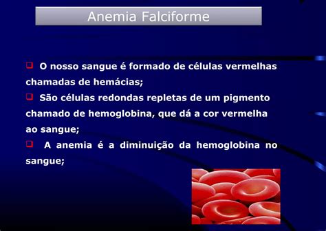 A Anemia Falciforme É Uma Doença Genética Que Se Caracteriza - Anemia falciforme genética | PPT