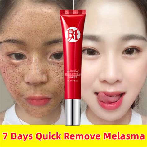 Days Effectivewhitening Freckle Cream Original G Remove