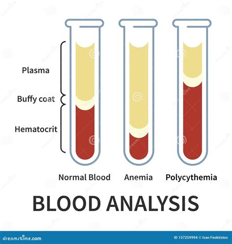 Datos De An Lisis De Sangre Ilustraci N Del Vector Ilustraci N De