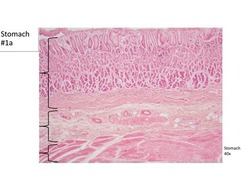 Stomach 1a Histology Quiz