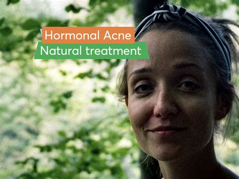 How Can I Treat Hormonal Acne Naturally? | MDacne