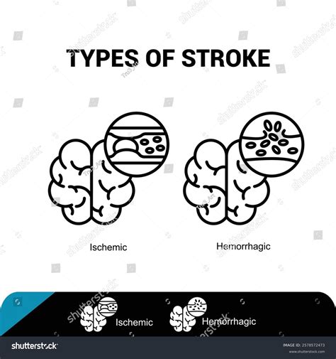 brain stroke icon ischemic hemorrhagic icon stock vector royalty