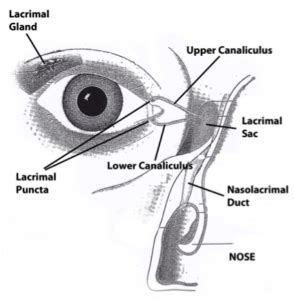 Endoscopic Tear Duct Surgery – OPSGA