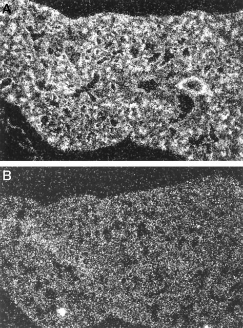 GATA 6 Activates Transcription Of Surfactant Protein A Journal Of