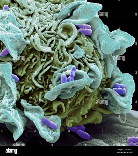 Macrophage Engulfing E Coli Bacteria Coloured Composition Scanning