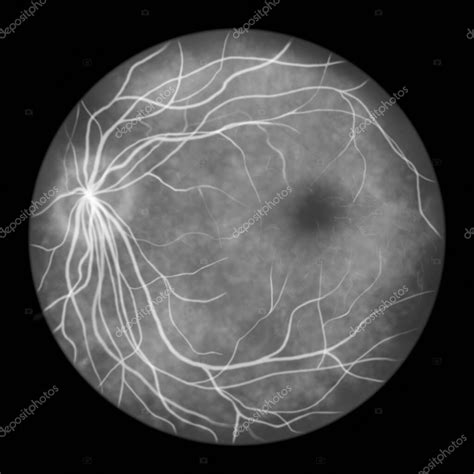 Retina Ocular Normal Ilustraci N Cient Fica Que Muestra Disco Ptico