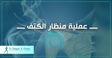 Shoulder arthroscopy - Dr Begad Clinic