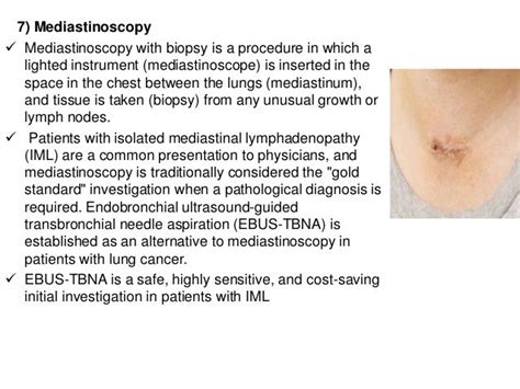 Interventions In Pulmonary Medicine