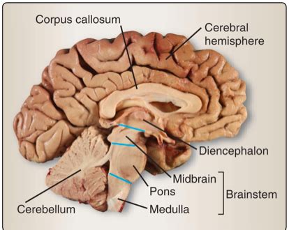 Brainstem And Cranial Nerves Flashcards Quizlet