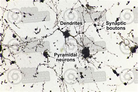 Mammal Cerebral Cortex Neuron Silver Stain X Neuron Mammals