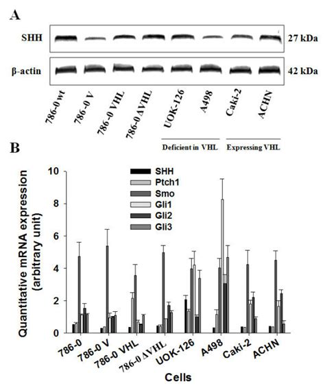 All The Shh Signaling Pathway Components Are Expressed In Human Crcc