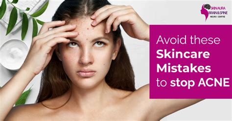 Avoid These Skincare Mistakes To Stop Acne