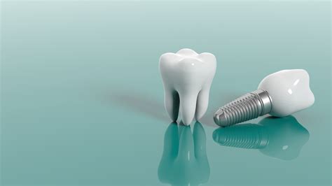 Dental Implant Care | Dental Galaxy