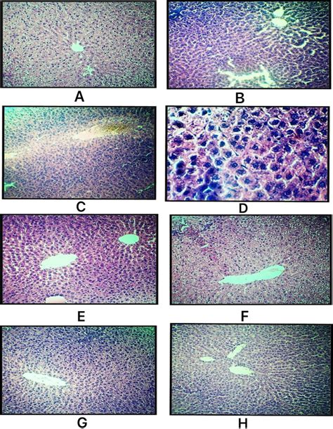 The Photomicrograph Of A Hande × 100 Correspond To Normal Liver Tissues