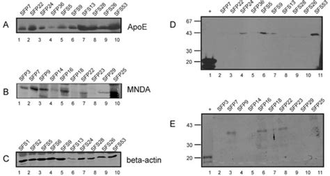 The Rheumatoid Arthritis Synovial Fluid Citrullinome Reveals Novel