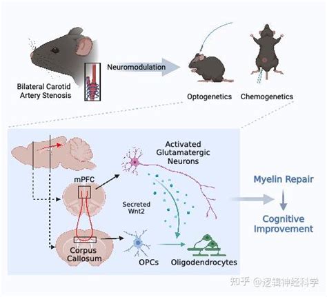 Adv Sci︱南京大学医学院附属鼓楼医院的徐运课题组揭示特异性激活内侧前额叶谷氨酸能神经元改善慢性缺血性脑白质损伤 知乎